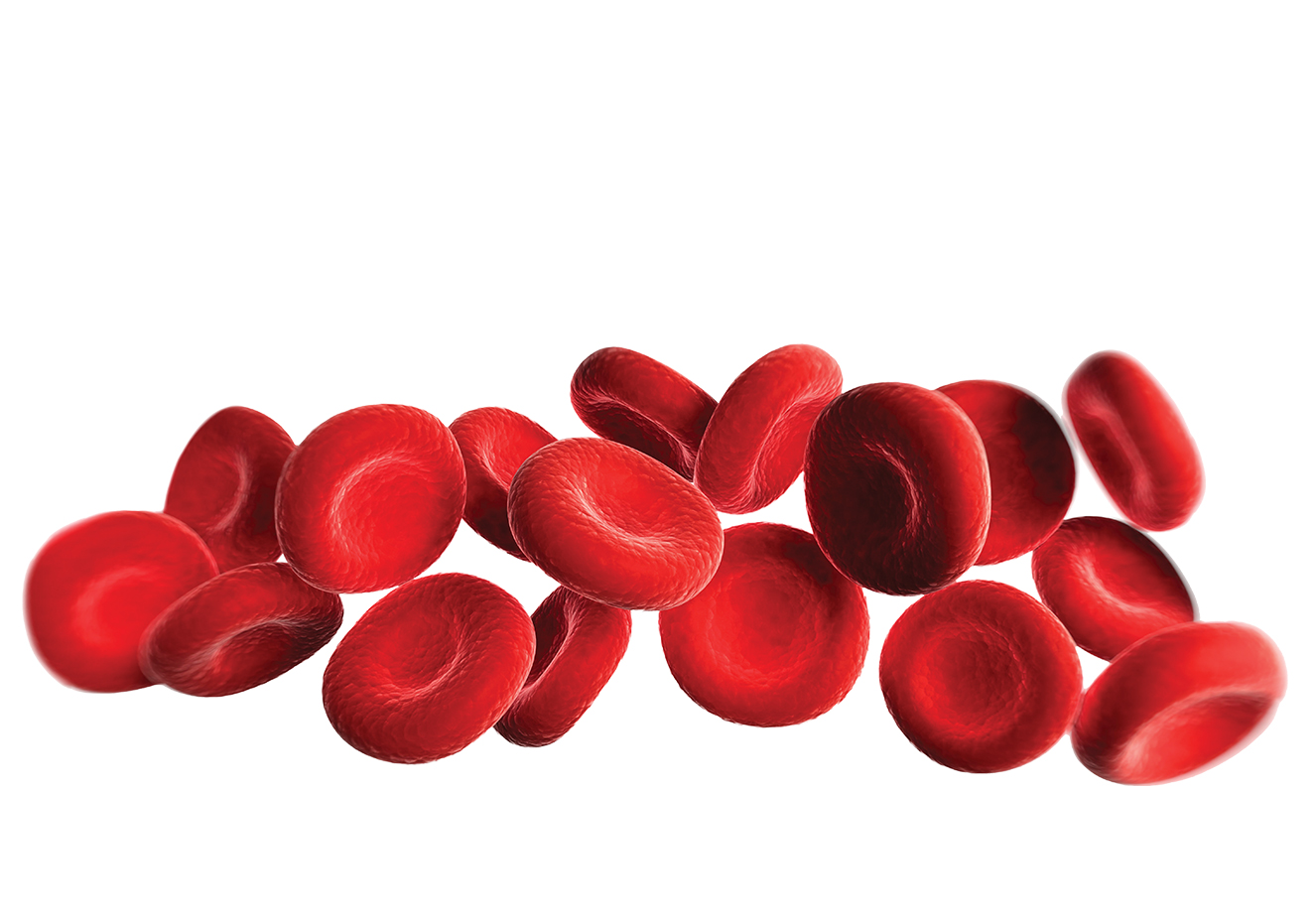 Anemia y colesterol alto