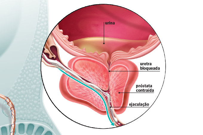 SQS Prostate Chart