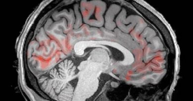 ¿Sabías que tu cerebro se lava literalmente durante el sueño? (video)