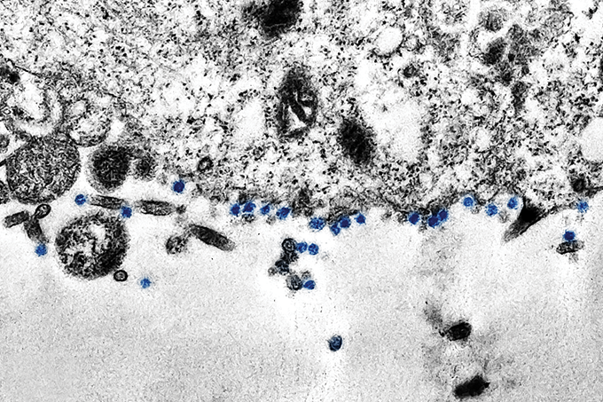 imagen microscópica del coronavirus