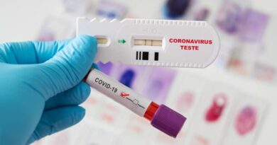COVID-19: Infetados podem criar anticorpos para toda a vida