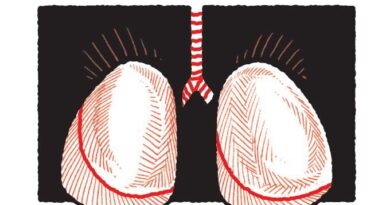 Cáncer de pulmón: causas, síntomas, diagnóstico y tratamiento