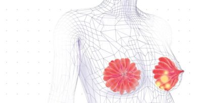¿Un método alternativo para detectar el cáncer de mama?